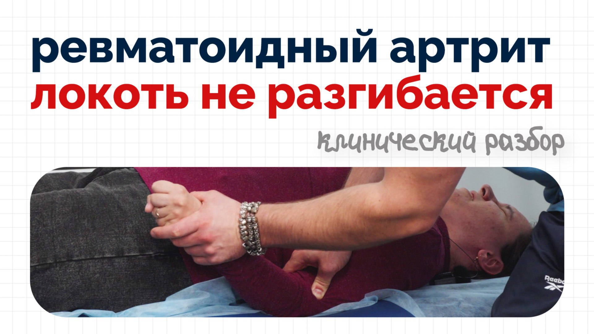 Локоть не гнется - ревматоидный артрит | Клинический разбор смотреть онлайн