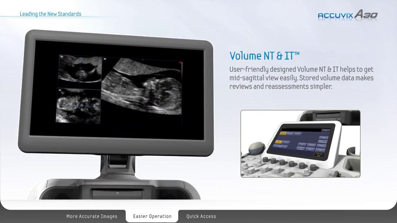 Samsung Medison Accuvix A30