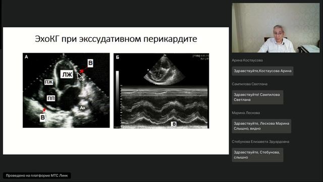 Заболевания перикарда этиология патогенез клиника диагностика лечение смотреть онлайн