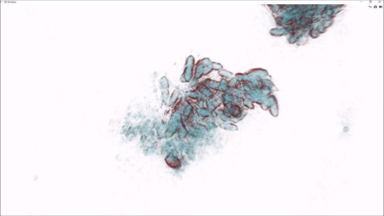E.coli Bacteria Lysis Caused By Bacteriophage T4