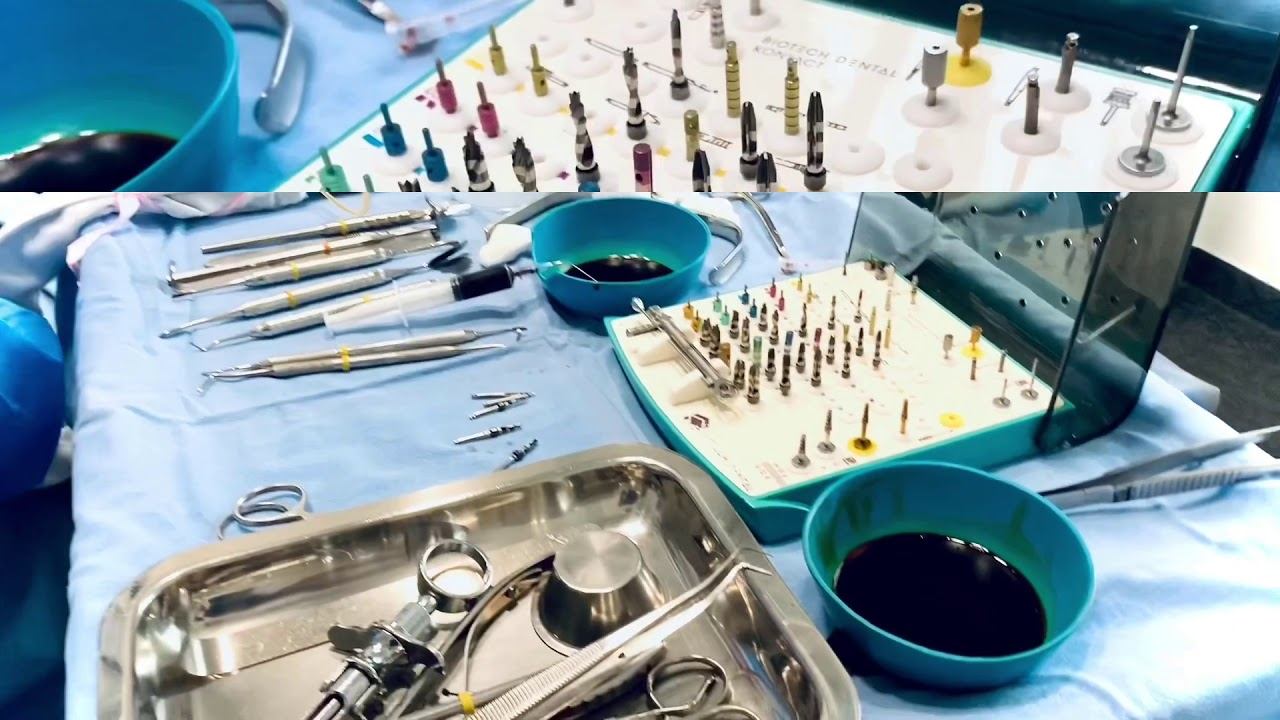 Kontact-Biotech Dental смотреть онлайн