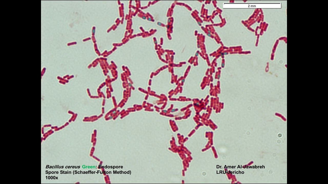 Bacillus cereus- Spore stain (Schaeffer-Fulton Method) смотреть онлайн