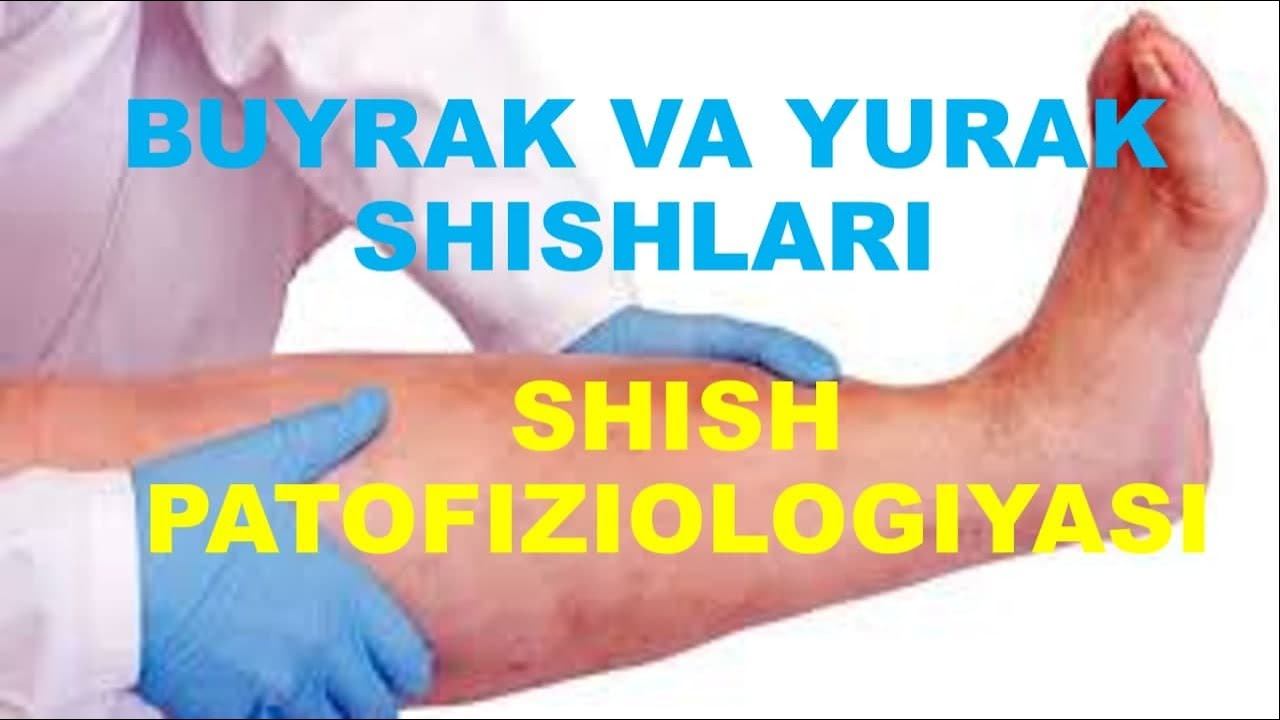 SHISH PATOFIZIOLOGIYASI // YURAK SHISHLARI // BUYRAK SHISHLARI // JIGAR SHISHLARI // OCHLIK SHISHI