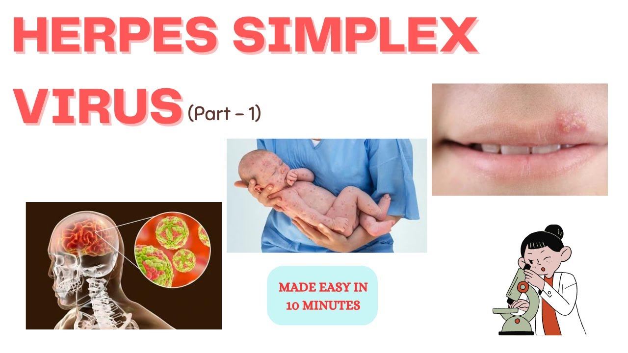 Herpes simplex virus | Part - 1| In just 10 minutes | Medinare смотреть онлайн