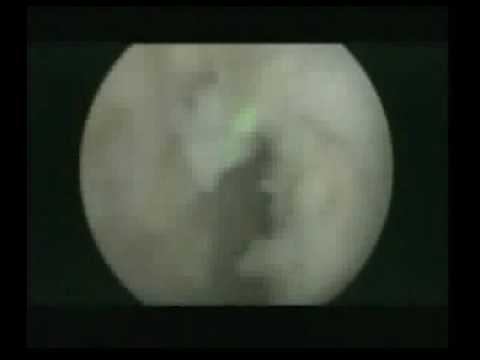 HOLEP-AURIGA-XL.VOB смотреть онлайн