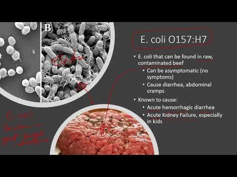 Chapter 6 Lecture - Part 1 смотреть онлайн
