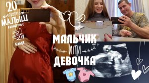 ВТОРОЙ СКРИНИНГ🥰УЗНАЁМ ПОЛ РЕБЁНКА🩷💙20 НЕДЕЛЬ БЕРЕМЕННОСТИ