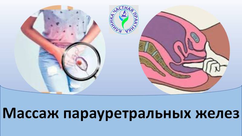 Массаж парауретральных желез смотреть онлайн