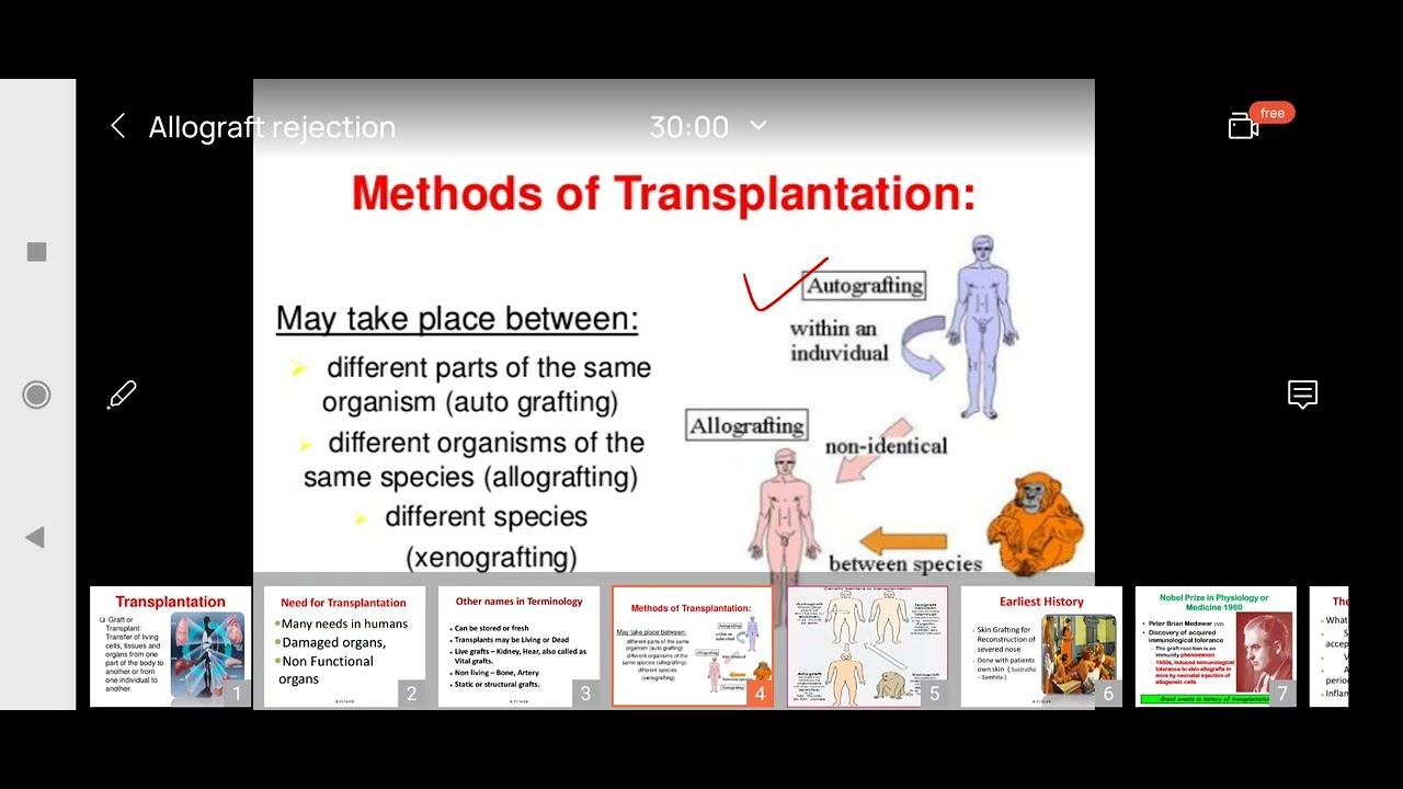 Transplantation Reaction/Types of Graft / Transplantation Antigens / Allograft Rejection . смотреть онлайн