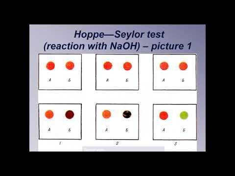 TFC Lecture 5 (VIII) Eng смотреть онлайн