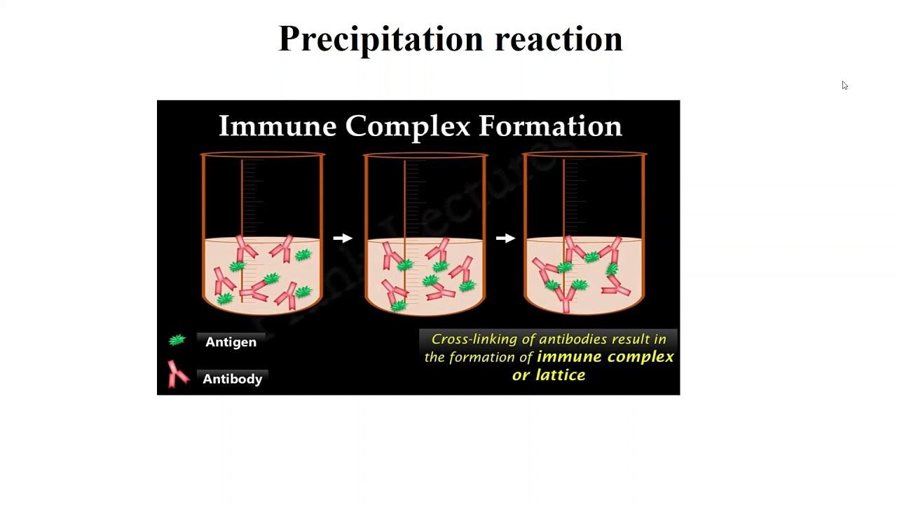 Antigen-Antibody reactions смотреть онлайн