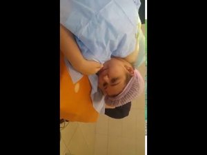 Удаление холки в Amira Clinic, часть 2