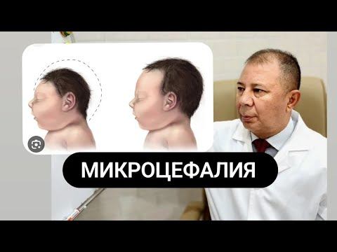 #МИКРОЦЕФАЛИЯ КАКИЕ УЛУЧШЕНИЯ ? ? ? смотреть онлайн