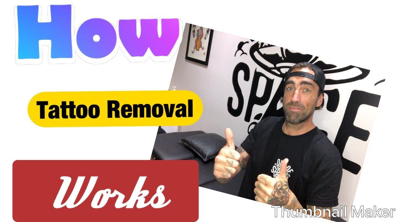 Laser Tattoo Removal Process and How it Works, By Alexander Dalitz смотреть онлайн