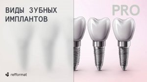 🦷👀 Виды зубных имплантов