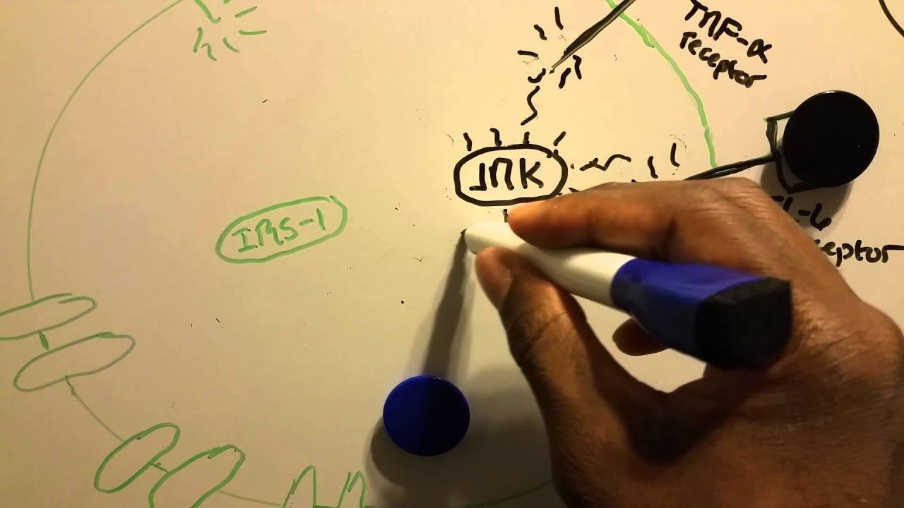 Type 2 diabetes insulin receptor inhibition mechan смотреть онлайн