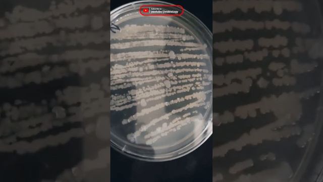 Isolated Bacterial colony | #micro #bacteria #virus #fungi смотреть онлайн