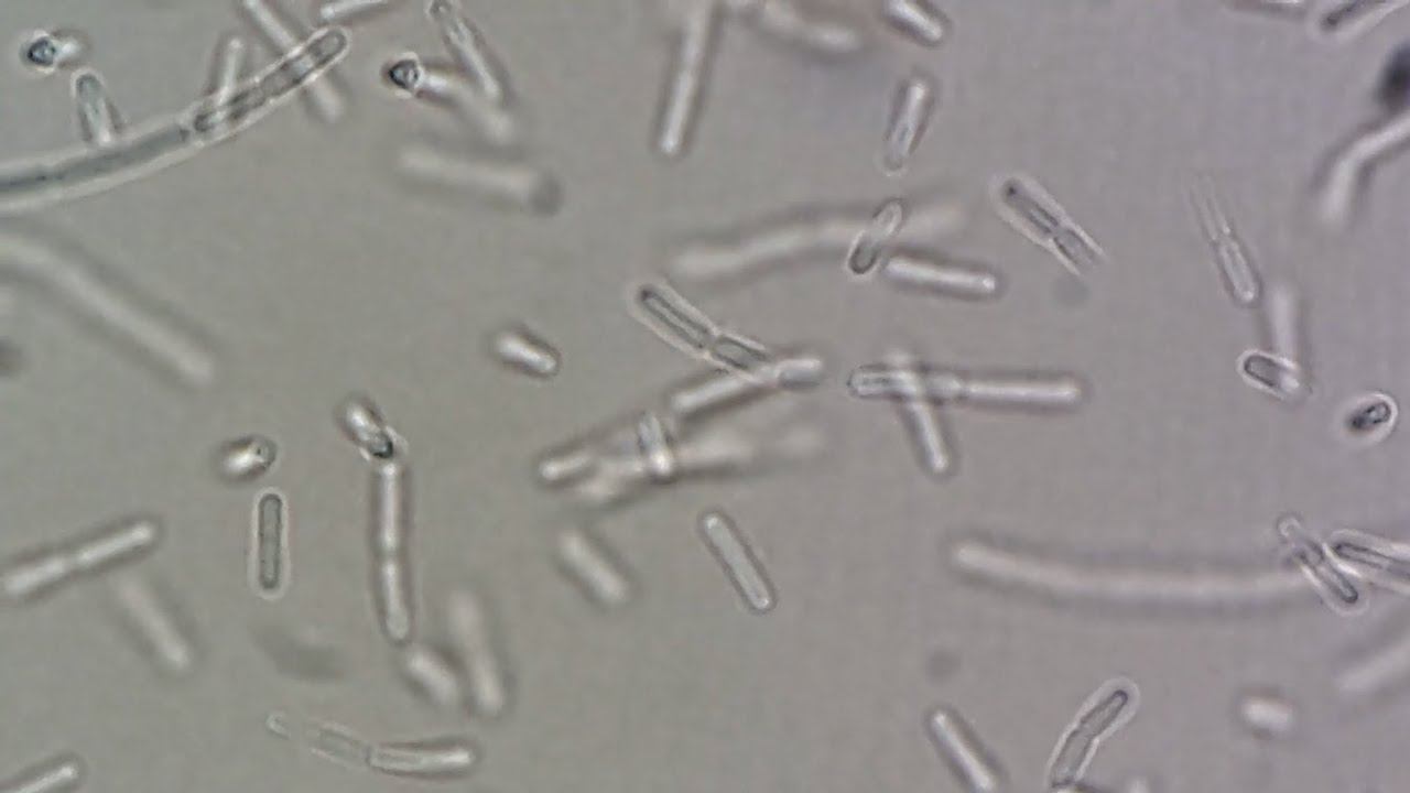 Bacillus spp смотреть онлайн