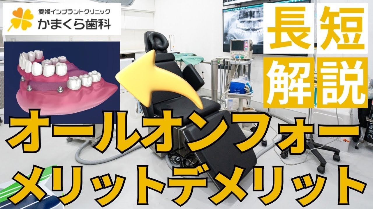 #インプラントのメリットデメリット смотреть онлайн