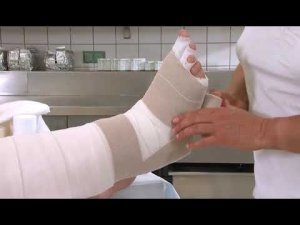 Лечение лимфостаза техника наложения повязки нога