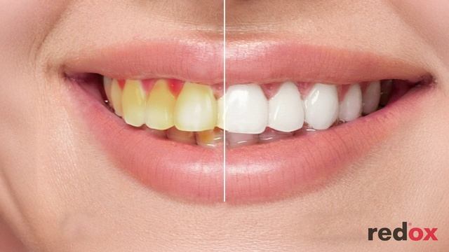 Пенка-мусс Redox для полости рта и зубов 3 в 1, эффекты