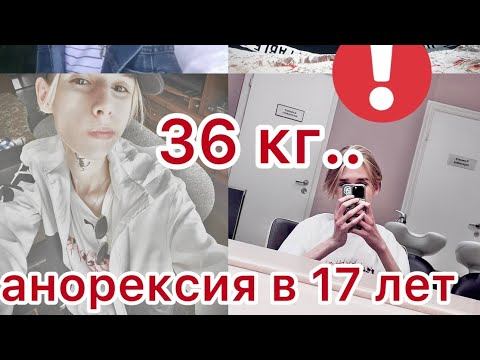 Моя история РПП Анорексия|36 килограмм в 17 лет|У парней тоже бывает рпп! смотреть онлайн