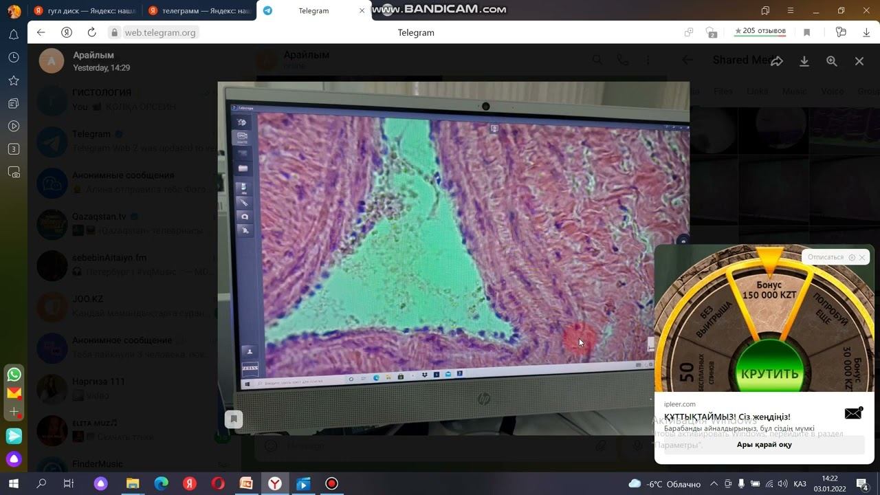 Вена гистология. Vena - histology in kazakh. смотреть онлайн