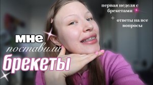 МНЕ ПОСТАВИЛИ БРЕКЕТЫ/ первые ощущения, ответы на вопросы ВЛОГ