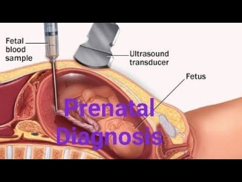 Genetics, Topic- Prenatal Diagnosis part-1 смотреть онлайн