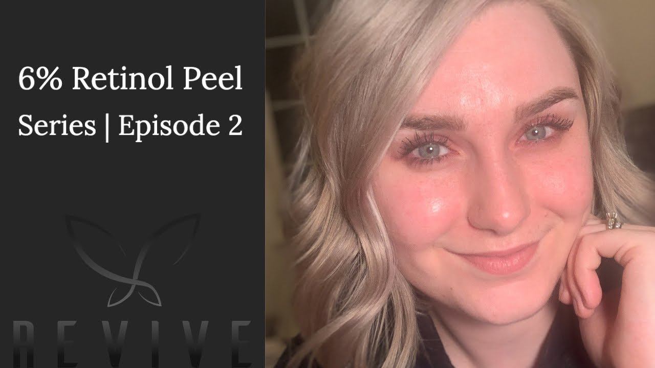 6% Pure Retinol Peel | Episode 2! смотреть онлайн