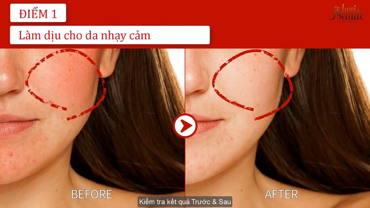 [FAU SOS Serum] – Serum làm dịu, giảm đỏ và phục hồi da смотреть онлайн