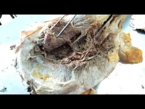 Structure passing through Greater and lesser sciatic foramen смотреть онлайн