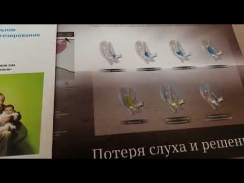 Типы слуховых аппаратов смотреть онлайн