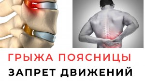 Запрещенные движения позвоночника для человека с грыжей поясницы Ротация и боковой наклон