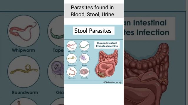 Parasites found in blood stool and urine #bloodparasite #stoolparasite #urine lparasite смотреть онлайн
