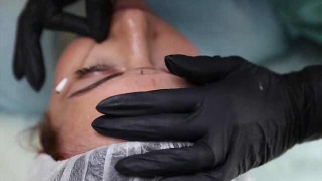Medico Derm - Société Spécialisée dans la Dermopigmentation смотреть онлайн
