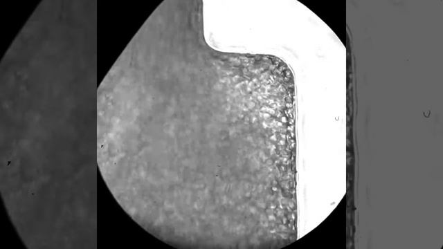 Microfluidic RBC flow visualization смотреть онлайн
