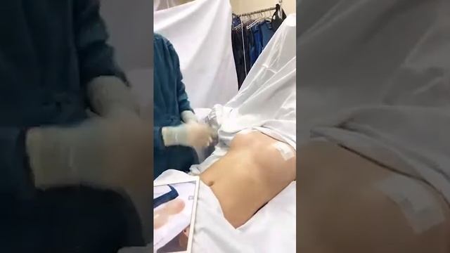 Nâng cấp ngực 255cc lên 380cc | 0947.966.229 смотреть онлайн