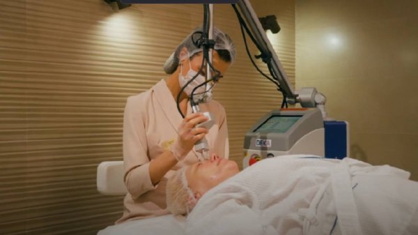 DERMAVI.Лазерная шлифовка DEKA CO2 ( DEKA SMART XIDE2)