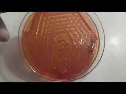 Acinetobacter, Klebsiella and Bacillus growth on culture media and Gram Stain Microscopy смотреть онлайн