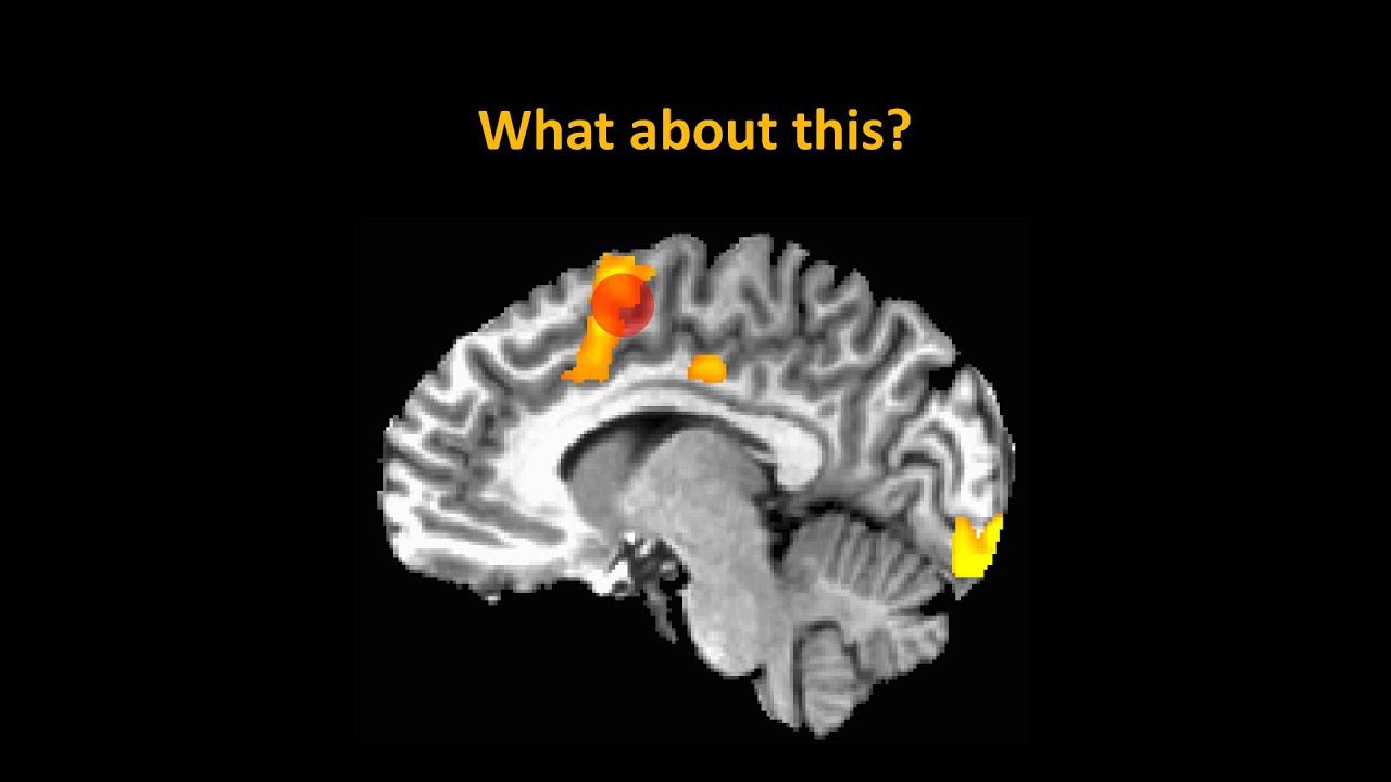 OSU Workshop, Part 1: fMRI Pitfalls смотреть онлайн
