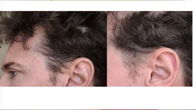 Grey Escape Serum - Update after 3 months: did it work? смотреть онлайн