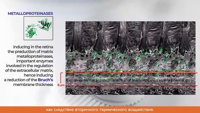 Лазер 2RT смотреть онлайн