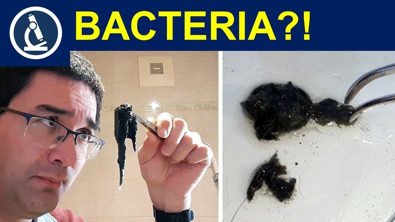 BACTERIA from SLUDGE under the Microscope 🔬 226 смотреть онлайн