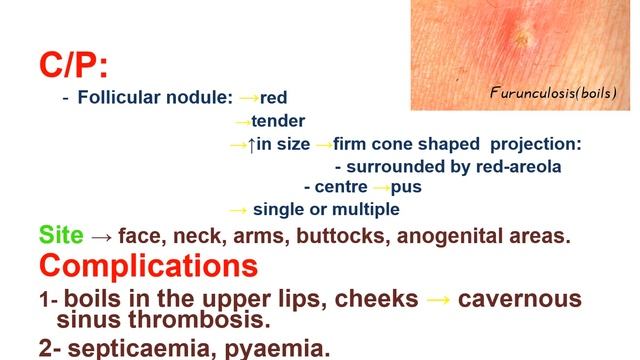 Derma L2 Bacterial infection of skin الكلية смотреть онлайн