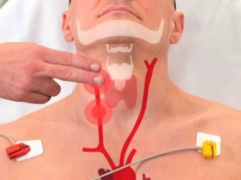 Carotid Sinus Massage (2017) смотреть онлайн