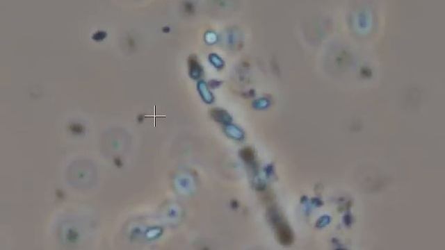 Bacillus thuringiensis bipyramidal crystals смотреть онлайн
