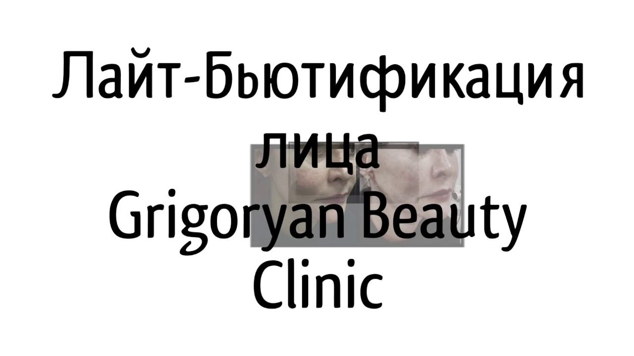 Бьютификация смотреть онлайн