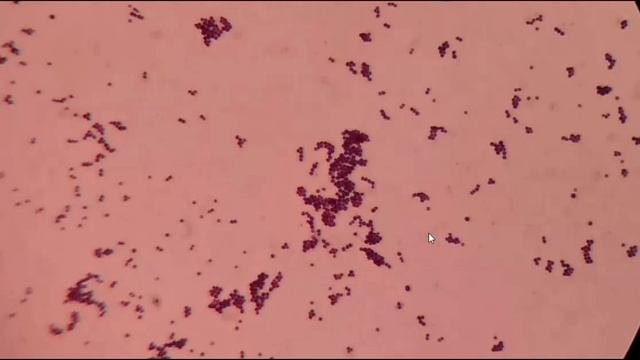Gram positive cocci under microscope | Gram positive bacteria | GPC in pair , chain and cluster смотреть онлайн