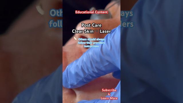 Post Care of Clear Skin ™️Laser Facial смотреть онлайн